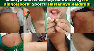 Malatya’daki U-14 Maçı Sonrası Olay: 10 Bingölsporlu Sporcu Hastaneye Kaldırıldı