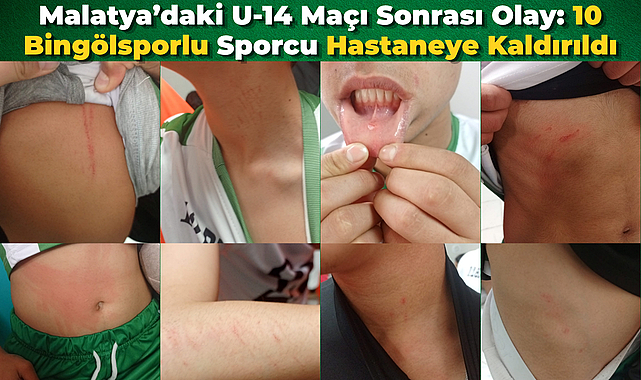 Malatya’daki U-14 Maçı Sonrası Olay: 10 Bingölsporlu Sporcu Hastaneye Kaldırıldı