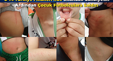 U-14 Türkiye Finalleri’nde Skandal: Galibiyetin Ardından Çocuk Futbolculara Saldırı