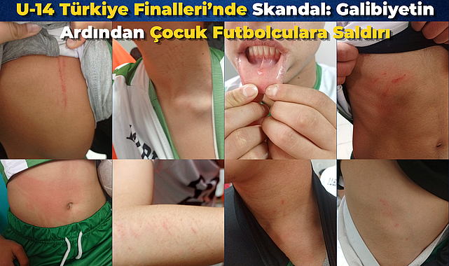 U-14 Türkiye Finalleri’nde Skandal: Galibiyetin Ardından Çocuk Futbolculara Saldırı